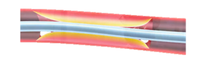 56.png