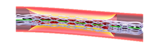 57.png